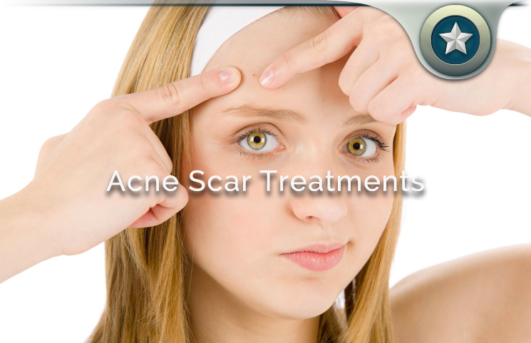 Acne Scar Treatments