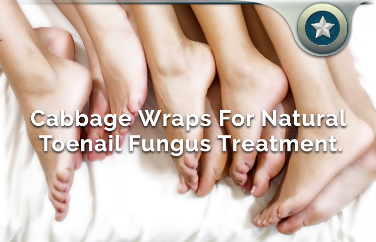 Cabbage Wraps Natural Toenail Fungus Treatment