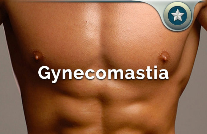 Gynecomastia Review How To Naturally Lose Enlarged Man Boobs