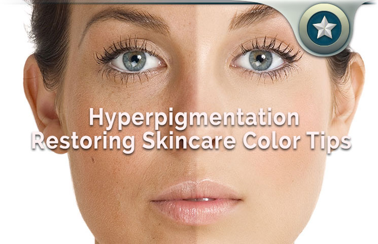 Meladerm for Hyperpigmentation