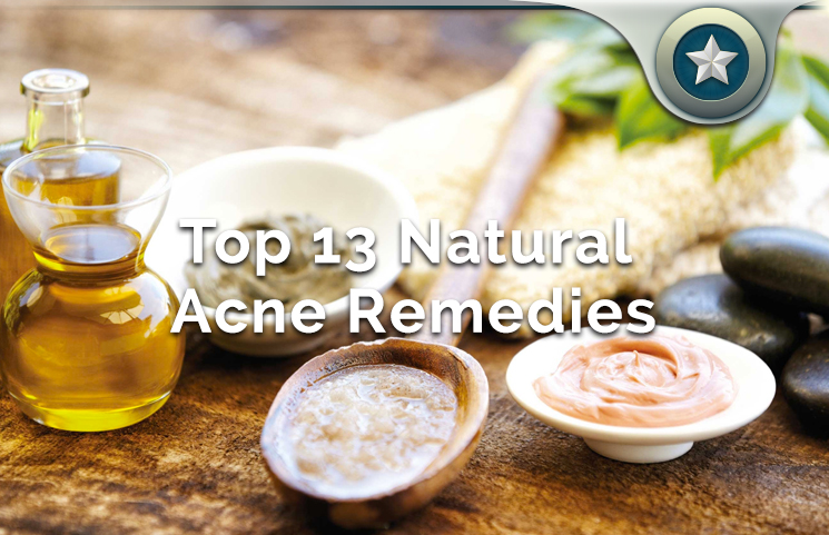 Top 13 Natural Acne Remedies