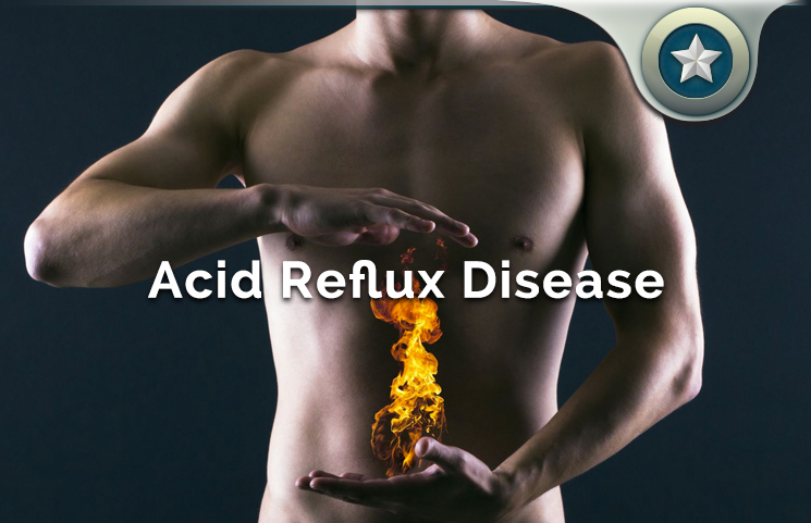 Acid Reflux Disease