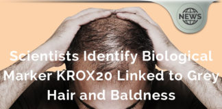 KROX20 & Stem Cell Factor Proteins Linked to Grey Hair and Baldness KROX20 & Stem Cell Factor Proteins Linked to Grey Hair and Baldness
