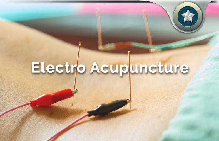 ElectroAcupuncture