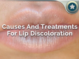 lip discoloration