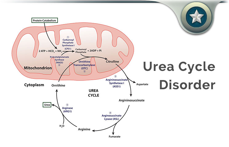 Urea Cycle Disorder