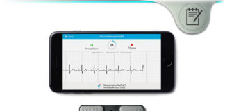 AliveCor – Single-Channel Mobile Cardiac Event Recorder App? alivecor